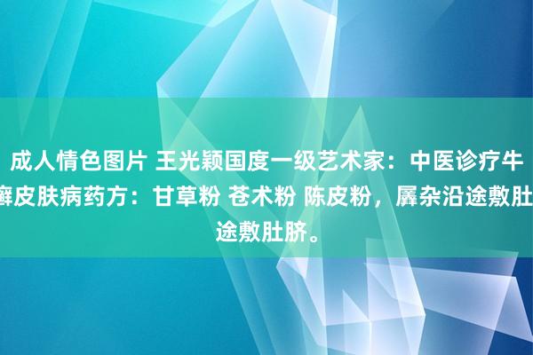 成人情色图片 王光颖国度一级艺术家：中医诊疗牛皮癣皮肤病药方：甘草粉 苍术粉 陈皮粉，羼杂沿途敷肚脐。